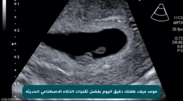 موعد ميلاد طفلك دقيق اليوم بفضل تقنيات الذكاء الاصطناعي الحديثة